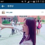 이 이마 <b>성형티나</b>?
