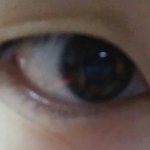 [댓글부탁해] 나 쌍수할까??