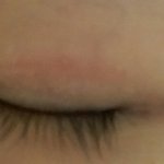 나<b>쌍</b><b>액</b>부작용인가ㅠ;;