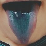 시2발풋<b>젤리</b>먹었는데