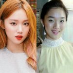 [댓글부탁해] <b>쌍수</b>할건데 눈이쁜 연예인!!!