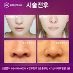 [드루와] 얘들아 <b>뷰티</b> 유투버 회사원 코성형함