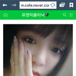 <b>하이코</b> 시술 전후