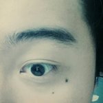 남잔데 눈<b>밑점</b> 뺄까요..?