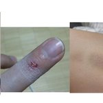 [꼭댓글부탁] 폭력의 <b>범위</b>?