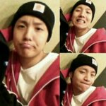 [방탄소년단] 호석이 <b>치아</b>교정