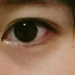내눈 답답해보여?