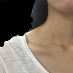 여자 <b>승모근</b> 봐주세요 ㅠㅠ