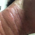 [꼭조언부탁] 회사에서 심하게 망가진 피부 어떡하죠??ㅠㅠ
