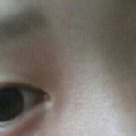[조언부탁해] 쌍수할까말까ㅜㅜ(<b>사진o</b>)
