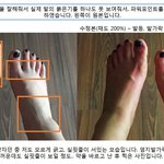 [개깊은빡침] 사진有) 유명한 풋 필링팩..! 부작용도 있어요!...