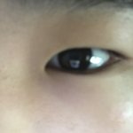 나 진짜 쌍수하고싶은데 부모님 어케 <b>설득</b>시키지 ㅠㅠㅠㅠㅠ(사진유