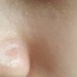 [댓글부탁해] 약혐?) <b>코</b>랑 <b>코옆</b> 피부ㅠㅠ