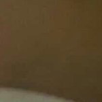 [댓글부탁해] ♧쌍수후기 5일째 약혐  사진ㅇ ♧