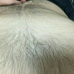 [꼭조언부탁] 몸에 털이 너무많아서 고민입니다...