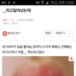 [EXO] <b>입술</b>박제