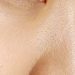 [꼭댓글조언] (사진 혐ㅈㅅ)이 두드러기같은 <b>피지</b> 없애는방법좀..