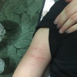 현재 이화여대 폭력<b>진압</b> 경찰폭행