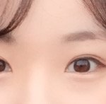 사진유)갑자기 <b>변해</b>버린 눈때문에 너무 속상해요..