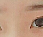 [드루와] 원래쌍커풀있는사람 쌍수후기