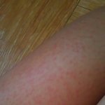 워터<b>파크</b> 물더럽다는거 맞는듯 (약혐)
