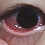 살짝 혐..? <b>눈</b> 간지러워서 비볐는데 <b>눈</b>에 이상한 막이 생겼어