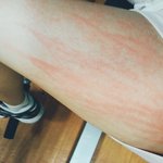 [인피니트] 사담) 운동했는데다리에ㅜㅜ
