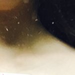 승모근 없애기 성공한사람있어요???