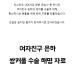 여자친구 <b>은하</b> 쌍수 안함ㅇㅇ