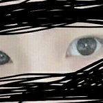 <b>유쌍</b>에 짝눈인데 쌍수할까?