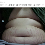 [댓글부탁해] 흔한 판남의 뱃살인증.jpg