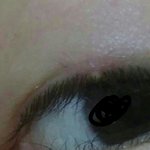 [댓글부탁해] 이거 안과 <b>가야</b>해????????????