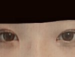 나 앞트임 할까말까