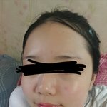피부<b>상태</b> <b>심각</b>하니??