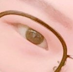 [댓글부탁해] 눈 좀 봐줘