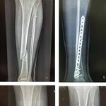 [개깊은빡침] 제주도에서 <b>의료</b>사고를 당했어요ㅠㅠ