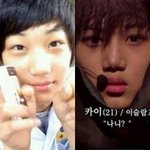 [EXO] 카이 쌍수 <b>절개</b>와 코성형