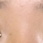 쌍수항까말까.....ㅈㄴ고민