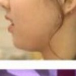 [댓글부탁해] 얼굴 옆태 이거 <b>턱살</b> 많아서 그런거야...?