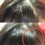 앞머리 가마 때문에 미치겠어 도와줘