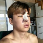 [댓글부탁해] 방탄 <b>지민</b> 코 성형 한 거였어...?