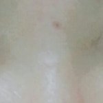 [쌍수고민ㅜ] 쌍수 고민