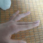 [댓글부탁해] 얘들아 <b>약지</b>가 ㅈㄴ부었어 도와줘