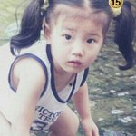 [모두드루와] 수지 성형 쌍수 증거