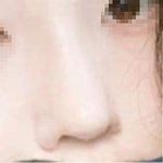 코 필러나 성형인지 자연인지 <b>판독</b>좀