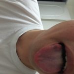 유럽 갔다가 퍽치기를 당했습니다