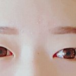 <b>짝눈</b>고정
