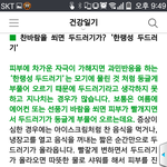 [댓글부탁해] 혹시 <b>여름철</b> 나같은증상가진 사람 있어.??