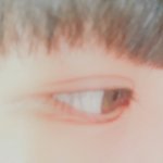 눈 쌍커풀 (<b>사진O</b>)