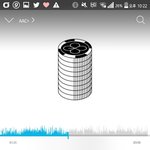 [EXO] 종대 눈 어디 다친거임?
